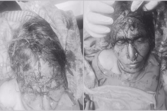 बैतडीमा दुई वृद्धामाथि खुकुरी प्रहार प्रकरण : ज्यान मार्ने उद्योगमा अनुसन्धान हुँदै 