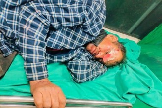 बैतडीमा मोटरसाइकल दुर्घटना हुँदा वडा अध्यक्ष घाइते 