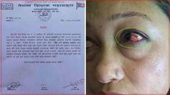 प्रधानाध्यापकलाई व्यवस्थापन समिति अध्यक्षले कुटेपछि...