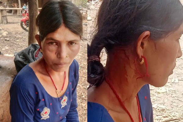 बैतडीको शिवनाथमा चितुवाको आक्रमणबाट एक महिला घाइते 