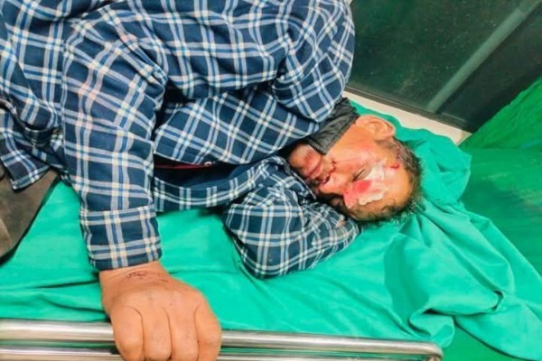 बैतडीमा मोटरसाइकल दुर्घटना हुँदा वडा अध्यक्ष घाइते 