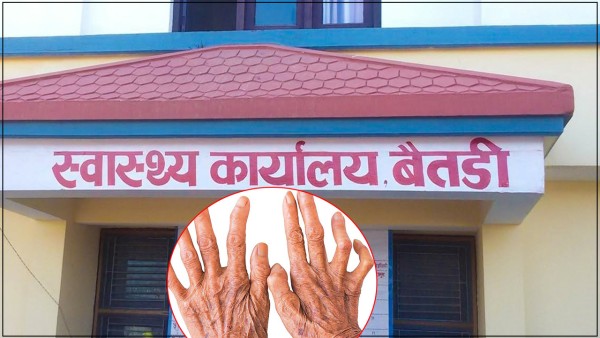 बैतडीमा तीन वर्षको अवधिमा १६ जनामा कुष्ठरोग