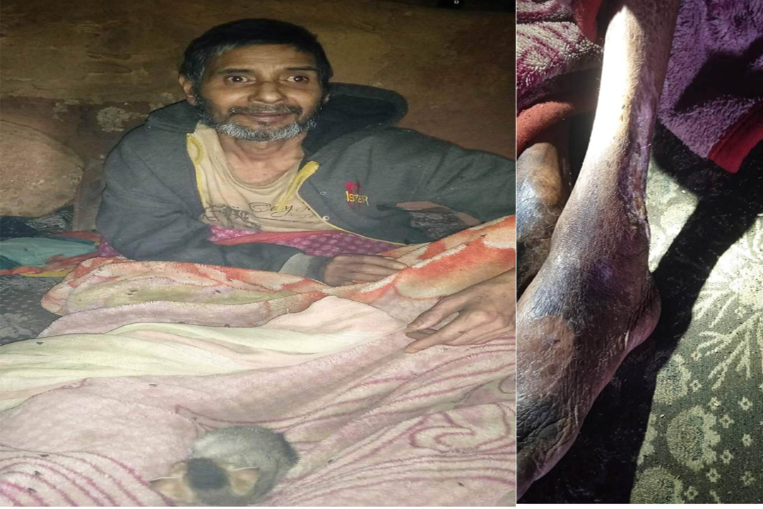 बैतडीका विष्ट एक वर्ष देखि बिस्तारामा, उपचार गर्न पैसा छैन्  ! 