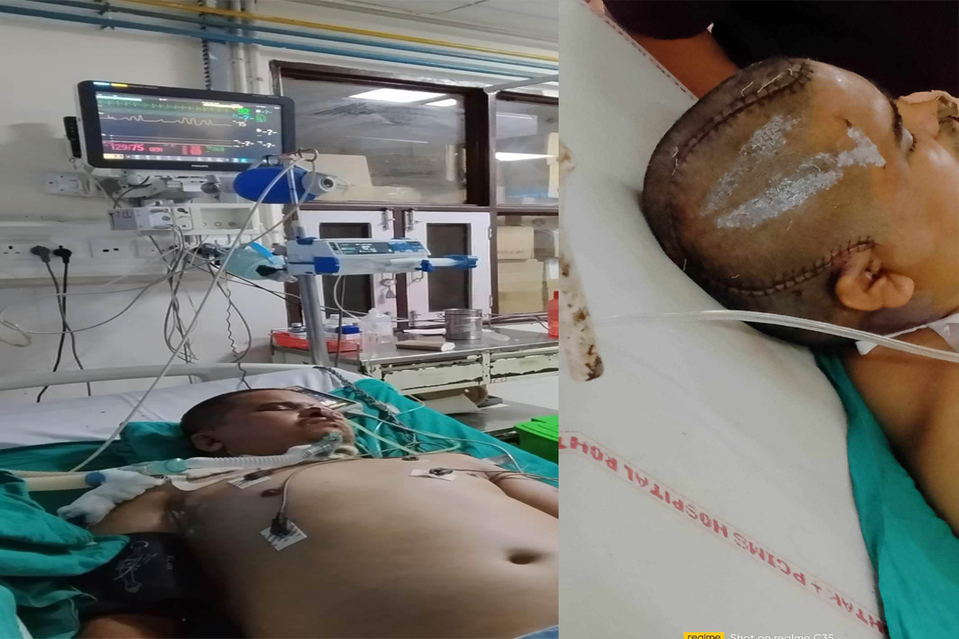 भारतमा दुर्घटना हुँदा बैतडीका विष्टको अवस्था गम्भीर, आर्थिक अभावले उपचारमा समस्या